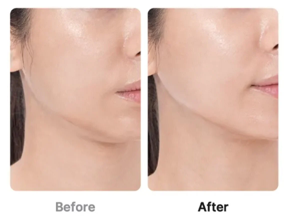 AGE-R Booster Pro - Image 10