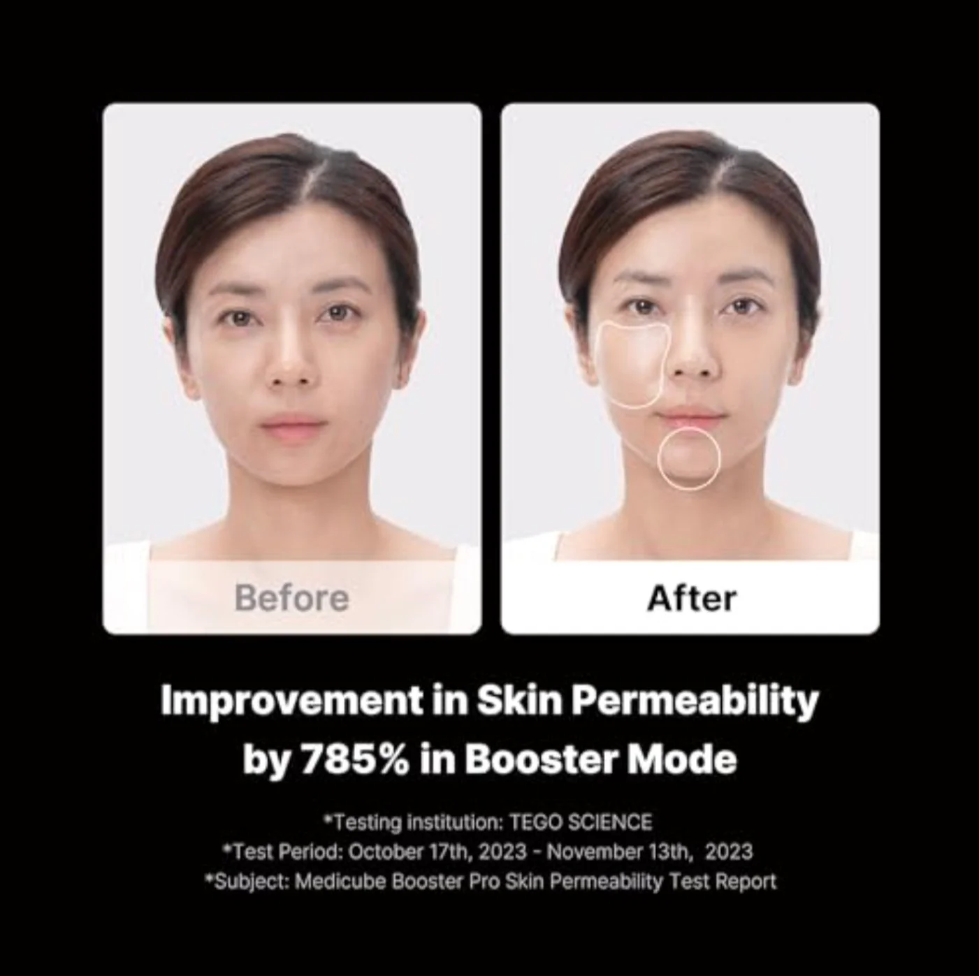 AGE-R Booster Pro - Image 9