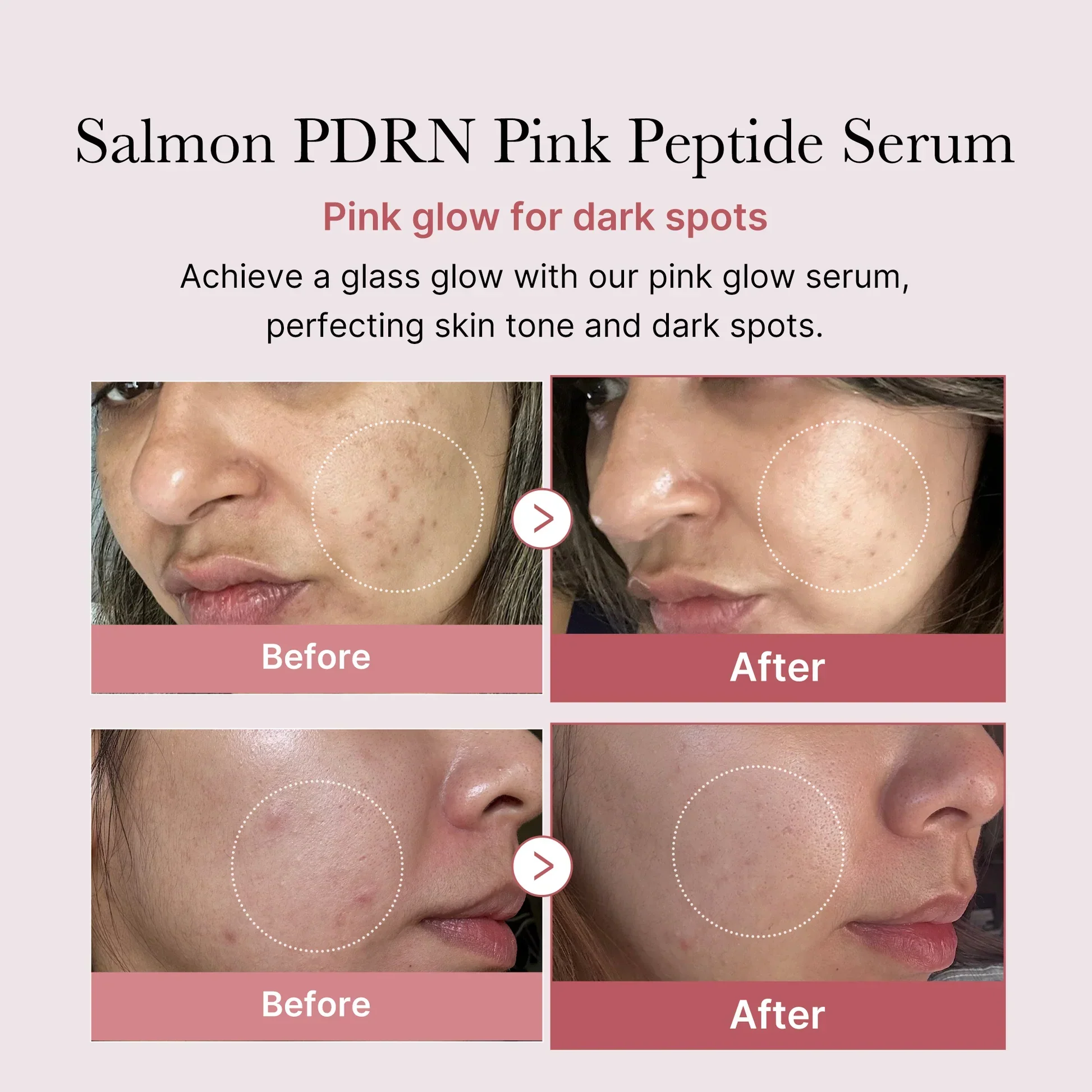 PDRN Pink Peptide Serum [30ml] - Image 4