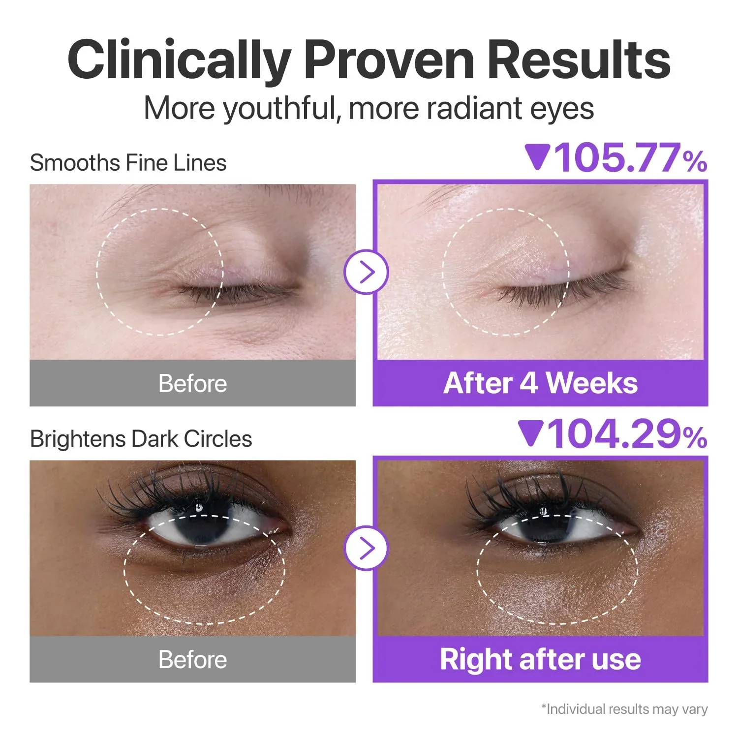 No.9 NAD+ Retinol Volumetox Eye Cream [10ml] - Image 4