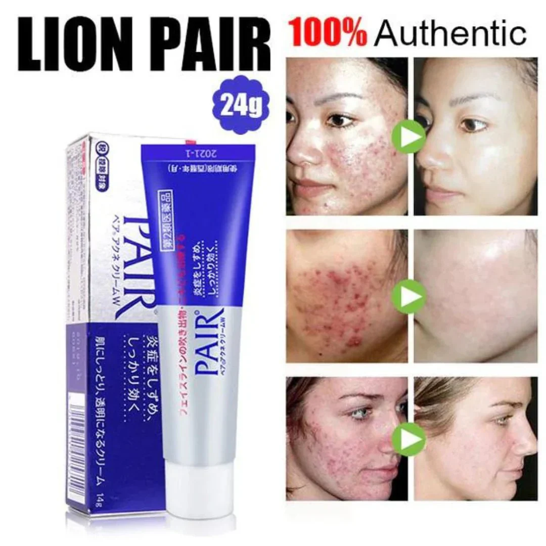 Pair Acne Cream W - Image 2