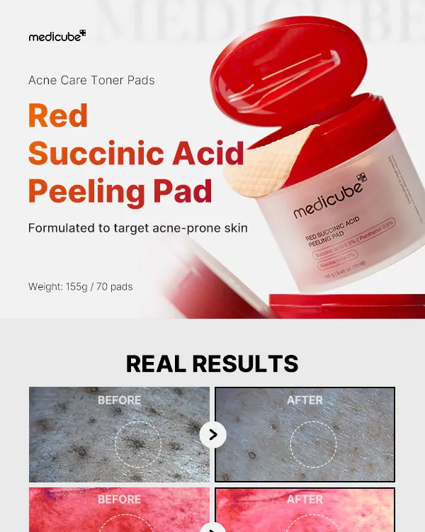 Red Succinic Acid Peeling Pad [70ea] - Image 3