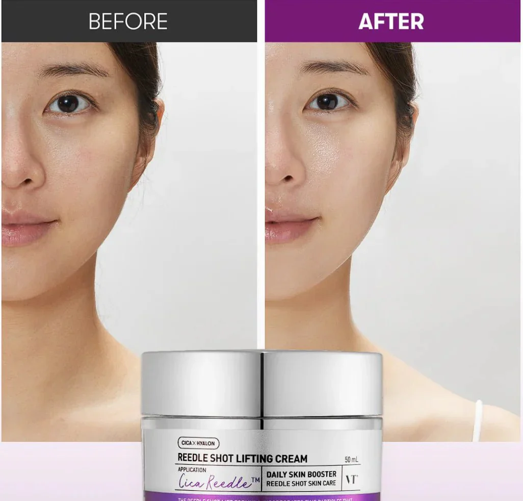 Reedle Shot Lifting Cream [50ml] - Image 3